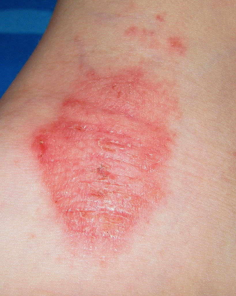 pinpoint red spot on skin